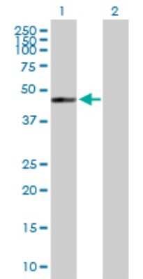 Western Blot: GTPBP5 Antibody [H00026164-B01P]