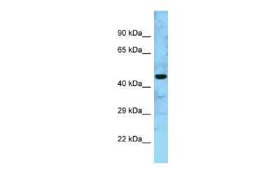 Western Blot: GTPBP5 Antibody [NBP2-85019]