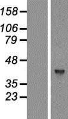 Western Blot: GTPBP5 Overexpression Lysate [NBP2-07123]