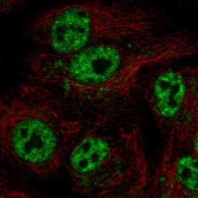 Immunocytochemistry/ Immunofluorescence: GTPBP6 Antibody [NBP3-17590]