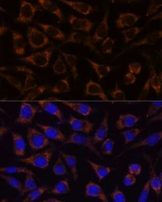 Immunocytochemistry/ Immunofluorescence: GTPBP8 Antibody - Azide and BSA Free [NBP3-04469]