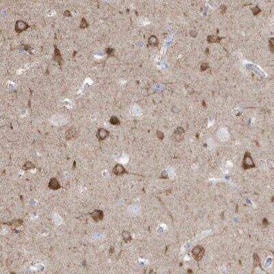 Immunohistochemistry-Paraffin: GTPBP8 Antibody [NBP1-81679]