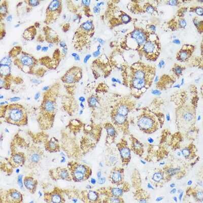 Immunohistochemistry-Paraffin: GTPBP8 Antibody - Azide and BSA Free [NBP3-04469]