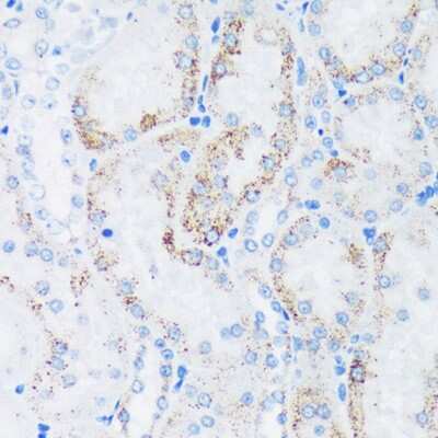 Immunohistochemistry-Paraffin: GTPBP8 Antibody - Azide and BSA Free [NBP3-04469]