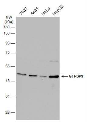 Western Blot: GTPBP9 Antibody [NBP2-16768]