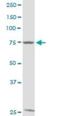 Western Blot: GTSE1 Antibody [H00051512-D01P]