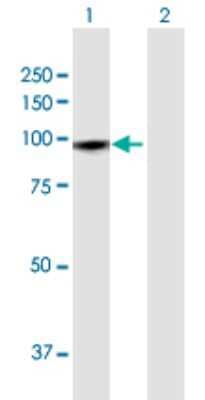 Western Blot: GTSE1 Antibody [H00051512-D01P]