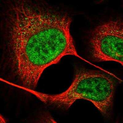 Immunocytochemistry/ Immunofluorescence: GTSF1 Antibody [NBP2-32625]