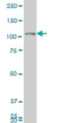 Western Blot: GUCY2C Antibody (2H8) [H00002984-M04]