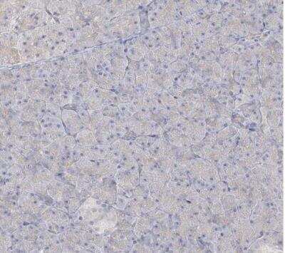 Immunohistochemistry-Paraffin: GUCY2C Antibody [NBP1-81788]