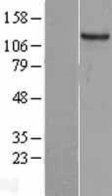 Western Blot: GUCY2C Overexpression Lysate [NBL1-11409]