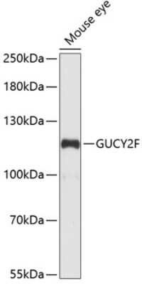 Western Blot: GUCY2F AntibodyAzide and BSA Free [NBP3-04892]