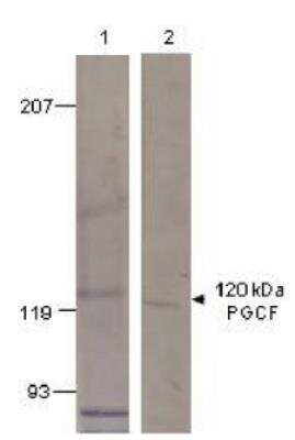 Western Blot: GUCY2F Antibody [NBP3-12219]