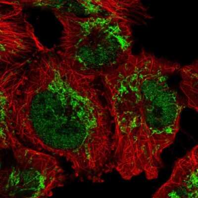 Immunocytochemistry/ Immunofluorescence: GUF1 Antibody [NBP2-58606]