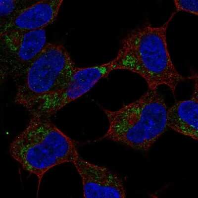 Immunocytochemistry/ Immunofluorescence: GVQW1 Antibody [NBP2-57676]