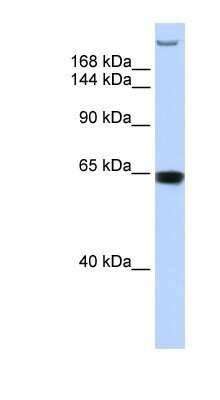 Western Blot: GW182 Antibody [NBP1-57134]