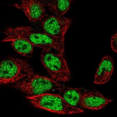 Immunocytochemistry/ Immunofluorescence: GXYLT2 Antibody [NBP2-49553]
