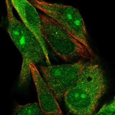 Immunocytochemistry/ Immunofluorescence: GYG2 Antibody [NBP2-39032]