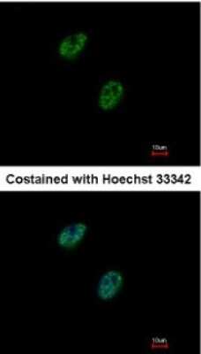 Immunocytochemistry/ Immunofluorescence: Gabpb2 Antibody [NBP1-33690]