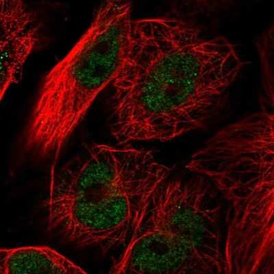 Immunocytochemistry/ Immunofluorescence: Gabpb2 Antibody [NBP1-81132]