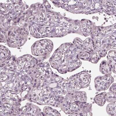 Immunohistochemistry-Paraffin: Galanin Antibody [NBP2-33582]