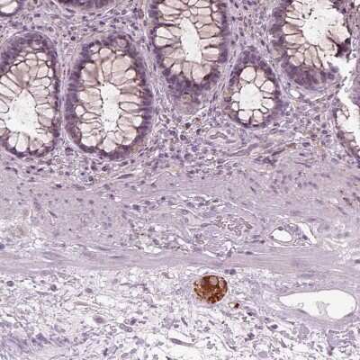 Immunohistochemistry-Paraffin: Galanin Antibody [NBP2-33582]