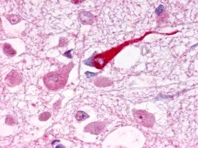 Immunohistochemistry-Paraffin: Galanin R1/GALR1 Antibody - BSA Free [NLS6168]