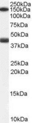 Western Blot: Galanin R1/GALR1 Antibody [NB100-57079]