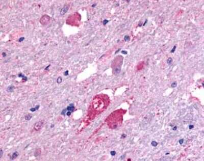 Immunohistochemistry-Paraffin: Galanin R2/GALR2 Antibody - BSA Free [NLS4156]