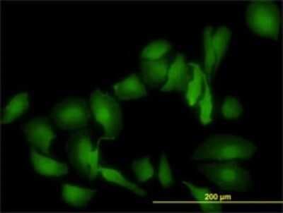 Immunocytochemistry/ Immunofluorescence: Galectin-1 Antibody (1E8-1B2) [H00003956-M01]