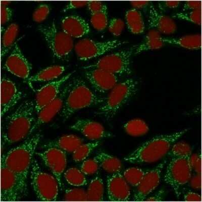 Immunocytochemistry/ Immunofluorescence: Galectin-1 Antibody (GAL1/1831) - Azide and BSA Free [NBP2-54457]