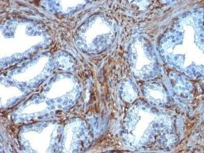 Immunohistochemistry-Paraffin: Galectin-1 Antibody (GAL1/1831) - Azide and BSA Free [NBP2-54457]