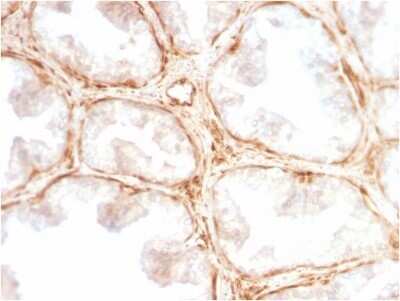 Immunohistochemistry-Paraffin: Galectin-1 Antibody (GAL1/2499R) - Azide and BSA Free [NBP2-79855]