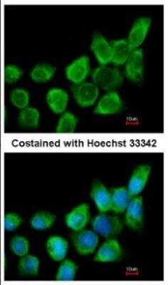 Immunocytochemistry/ Immunofluorescence: Galectin-1 Antibody [NBP2-16581]