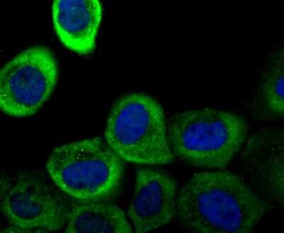 Immunocytochemistry/ Immunofluorescence: Galectin-1 Antibody (JM13-37) [NBP2-75499]