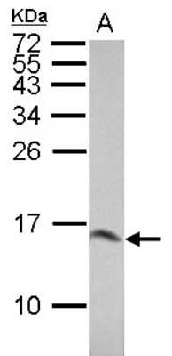 Western Blot: Galectin-1 Antibody [NBP2-16580]
