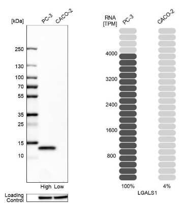 Western Blot: Galectin-1 Antibody [NBP2-76490]