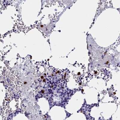 Immunohistochemistry-Paraffin: Galectin-10 Antibody [NBP1-87688]