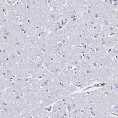 Immunohistochemistry-Paraffin: Galectin-10 Antibody [NBP1-87688]