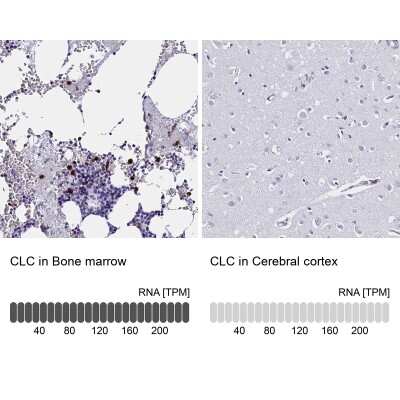 Immunohistochemistry-Paraffin: Galectin-10 Antibody [NBP1-87688]