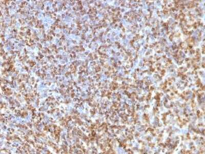 Immunohistochemistry-Paraffin: Galectin 13 Antibody (PP13/1161) [NBP2-53210]