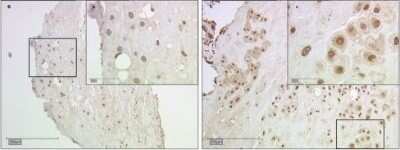 Immunohistochemistry: Galectin-2 Antibody [NBP1-89690]
