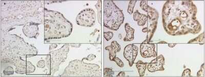 Immunohistochemistry: Galectin-2 Antibody [NBP1-89690]