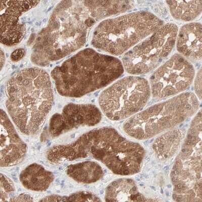 Immunohistochemistry-Paraffin: Galectin-2 Antibody [NBP1-89690]