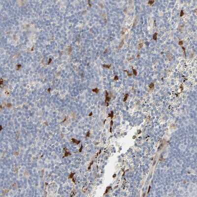 Immunohistochemistry-Paraffin: Galectin-2 Antibody [NBP1-89690]