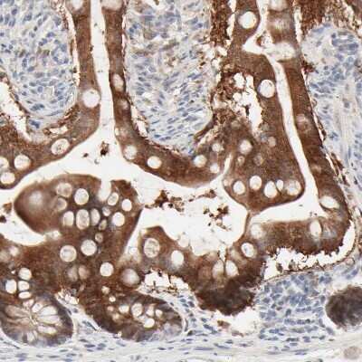 Immunohistochemistry-Paraffin: Galectin-2 Antibody [NBP1-89690]