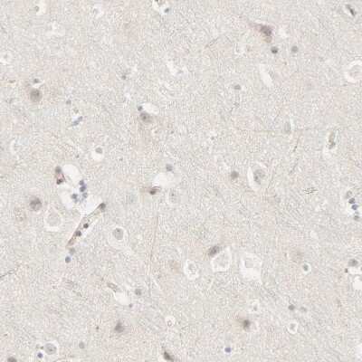 Immunohistochemistry-Paraffin: Galectin-2 Antibody [NBP1-89690]