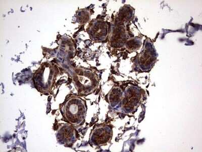 Immunohistochemistry: Galectin-3 Antibody (OTI1C7) [NBP2-45618]