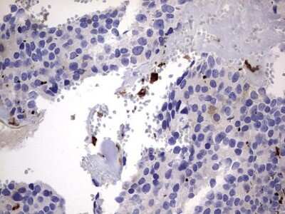 Immunohistochemistry: Galectin-3 Antibody (OTI1C7) [NBP2-45618]