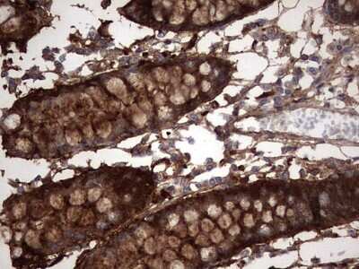 Immunohistochemistry: Galectin-3 Antibody (OTI1C7) [NBP2-45618]